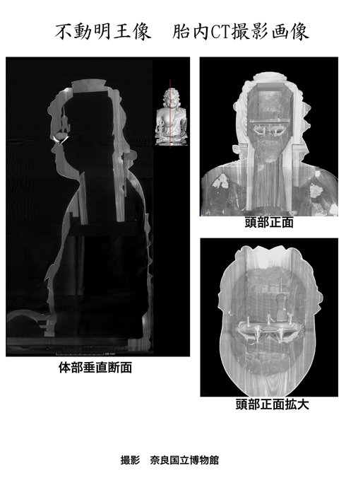 不動明王像CT撮影画像